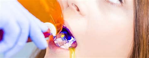 Dental Sealants Mirage Dental Se Calgary Dentist