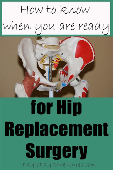 How To Know When You Are Ready For Hip Replacement Surgery Artofit