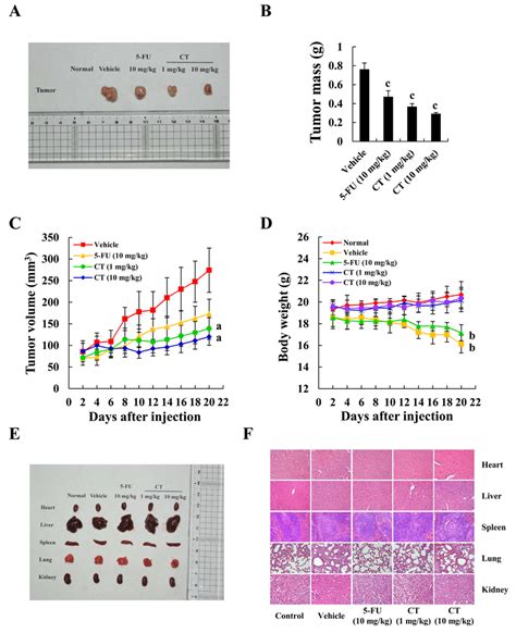 Inhibition Of Gastric Cancer Tumor Xenograft Growth By CT MKN 45 Cells