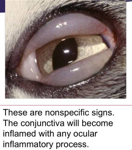 Conjunctiva Lacrimal System Nl System Flashcards Quizlet