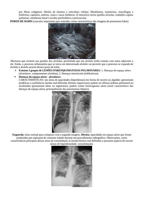 Solution Resumo T Rax E Abdome Radiografia Imagiologia