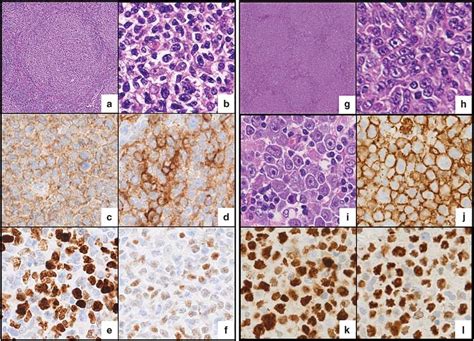 Histology Immunohistochemistry And Fluorescence In Situ Hybridization