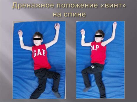 Кинезитерапия при муковисцидозе - презентация онлайн