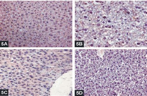 Representative Slides Showing Immunohistochemical Staining For P53 Download Scientific Diagram