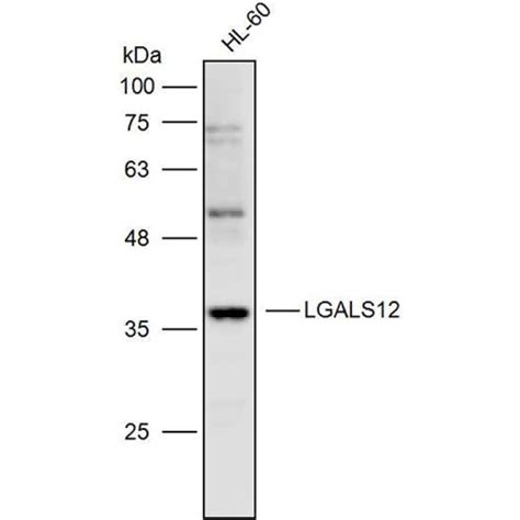 Solarbio K P Anti Lgals Polyclonal Antibody