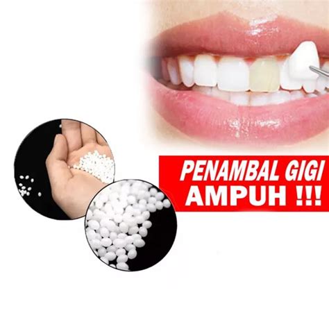 Jual Penambal Gigi Berlubang Instan Dengan Temptooth / Gigi Palsu ...