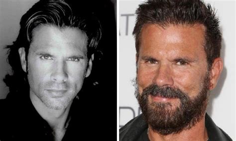 Lorenzo Lamas Before And After Plastic Surgery Facelift Botox