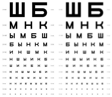 Зрение минус 1: что значит и что делать. Советы офтальмологов.