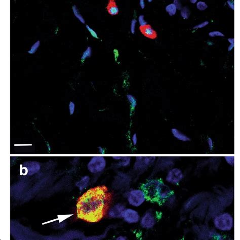 A Confocal Image Of Double Immunofluorescence Labeling Of Tryptase And