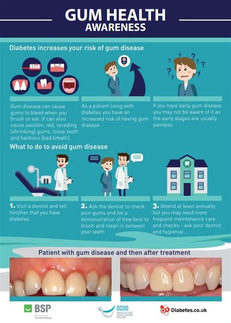 Diabetes And Gum Disease Heath Dental