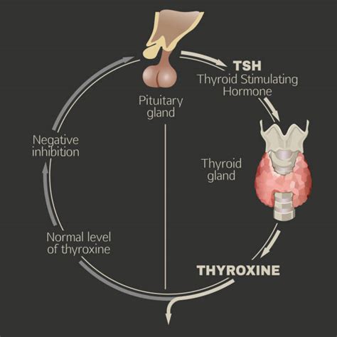 Hypothyroidism Illustrations Royalty Free Vector Graphics And Clip Art