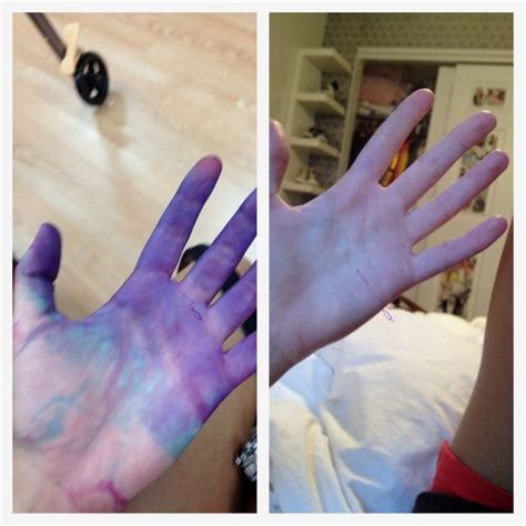 how to get rid of tie dye on skin