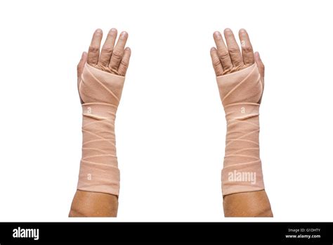 Arm Bone Stock Photos And Arm Bone Stock Images Alamy