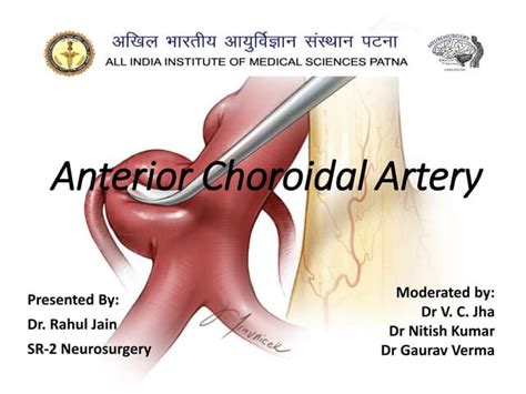 Anterior Choroidal Artery: Anatomy, Variants, and Clinical Significance | PPT