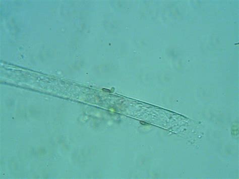 Microorganisms In Pond Water Under Microscope