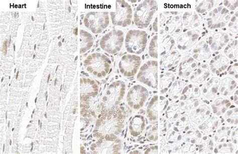 Glucocorticoid Receptor Nr C Monoclonal Antibody Hl