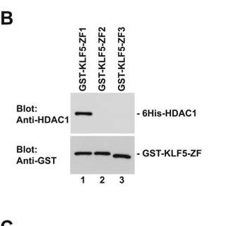 Schematic Representation Of Results Hdac Interacts Directly With The