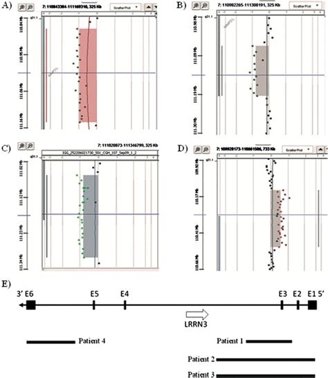 Results of array-CGH analysis in our cases 1, 2, 3, and 4. A) Array-CGH... | Download Scientific ...