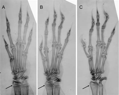 Inverted Digital X Ray Images Of Left Hands Of Tupaia Minor