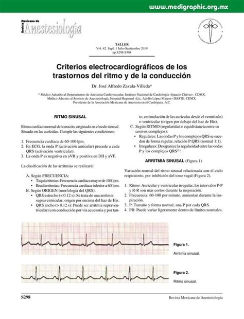 Criterios Electrocardiogr Ficos De Los Trastornos Del Ritmo Y De La