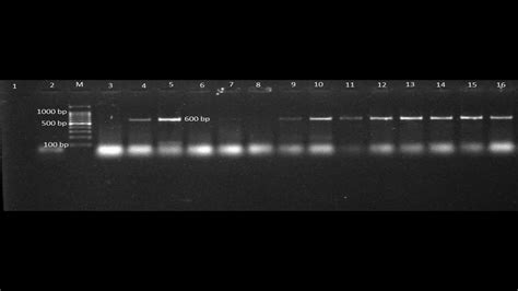 How To Label Gel Electrophoresis Pictures For Thesis And Research Articles Youtube