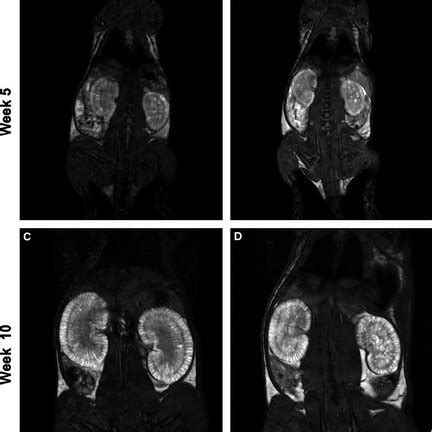 Representative T2 Weighted MR Images Of Kidneys From Lewis Polycystic