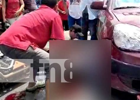 Hombre Pierde Una Pierna A Causa De Un Accidente En Masaya Tn8 Tv