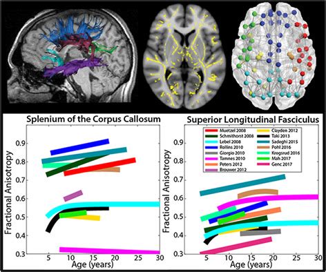 Diffusion Mri Of The Brain The Naked Truth Nmr In Biomedicine Vol