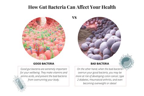 Bifidobacterium Longum-Benefits Of This Powerful Probiotic Bacteria | Prana Thrive