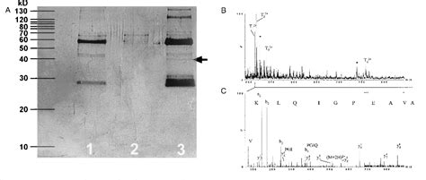 Figure 3 From Human Monoclonal Rheumatoid Synovial B Lymphocyte