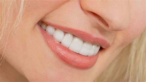 How Much Do Lumineers Vs Veneers Cost Veneers Teeth Cost Veneers