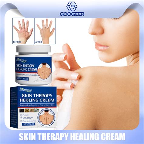 South Moon Skin Therapy Healing Cream Skin Antipruritic Cream Itch