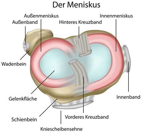 Meniskusriss Diagnose Und Behandlung ATOS Thema