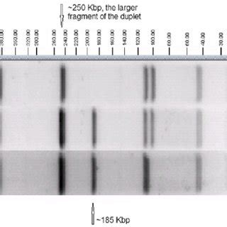 Three Asci Pfge Banding Patterns Observed Among Outbreak Associated