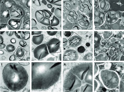 TEM Micrographs Of Starch Granules In The Developing Endosperm A D