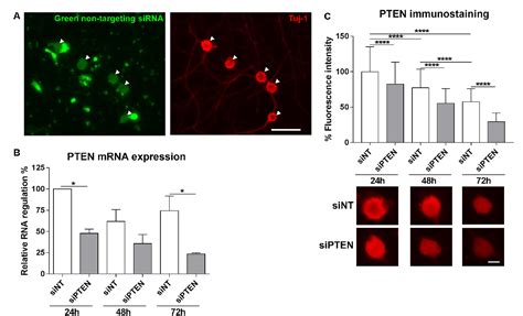 Figure From Simultaneous Knockdown Of Sprouty And Pten Promotes Axon