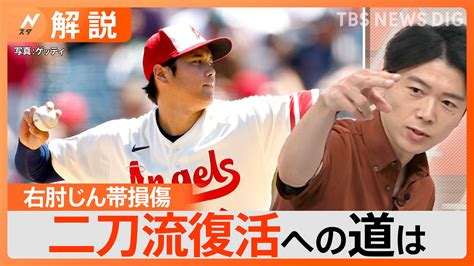 どうなる？二刀流、大谷翔平選手が右肘じん帯損傷、“部分損傷”と“完全損傷”で変わる治療法【nスタ解説】 Tbs News Dig