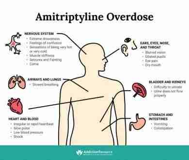 Amitriptyline Overdose: Symptoms And Treatment | Infographics Archive