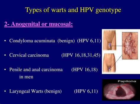 Ppt Genital Herpes And Genital Warts Powerpoint Presentation Free Download Id8709954