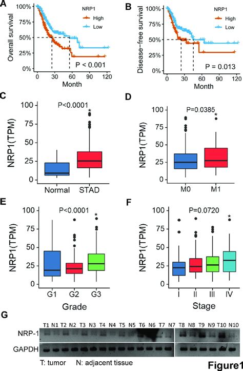 Nrp1 Highly Expressed In Gastric Cancer And Predicts Poor Prognosis