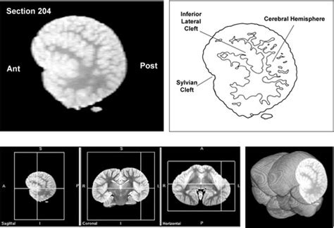 Neuroanatomy of the common dolphin (Delphinus delphis) as revealed by ...