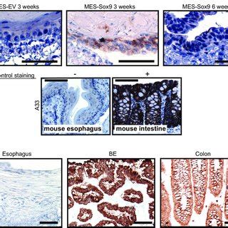 Ectopic Expression Of Sox9 In MES Cells Induces Expression Of Columnar