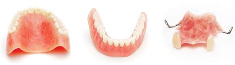 Immediate Dentures Denture Professionals Rockingham And Pinjarra