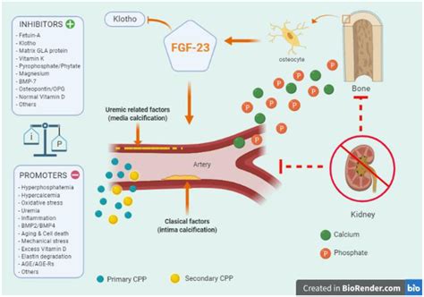 Key Aspects Of Vascular Calcification VC In Chronic Kidney Disease