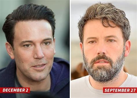 Ben Affleck improving his look with plastic surgery?