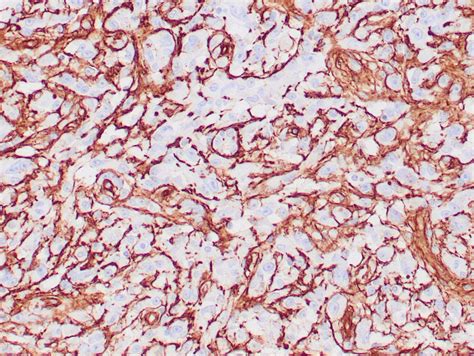 Collagen Type IV Antibody - Recombinant IVD Antibody for IHC - Zeta ...