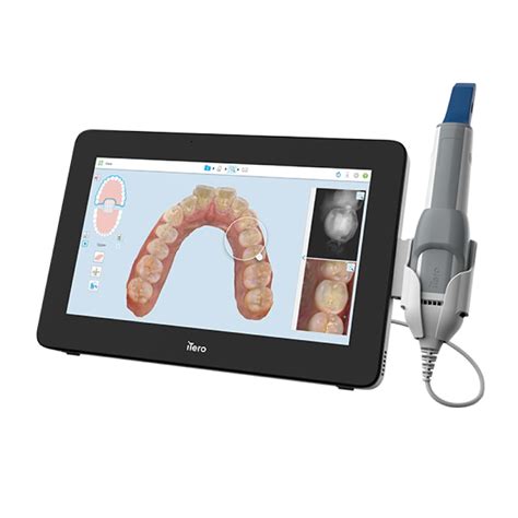 Itero Element 5d Plus Cart Medimatch Dental Laboratory