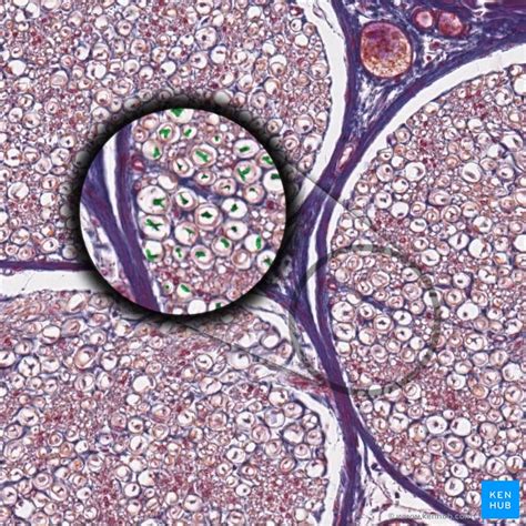 Histology of neurons: Morphology and types of neurons | Kenhub