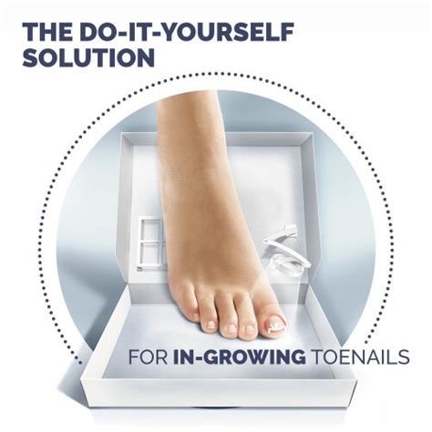 Scholl Ingrown Toenail Treatment Kit Ingrown Toenail Kit On Onbuy