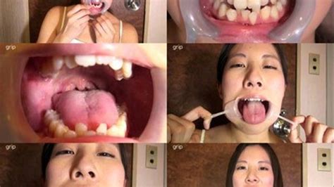 Misaligned Teeth And Wet Tongue Exposed Full Version High Quality Deviant Dentist Mouth Fetish